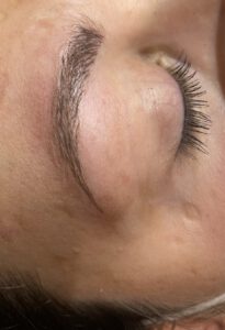 Microblading Hannover vorher nachher