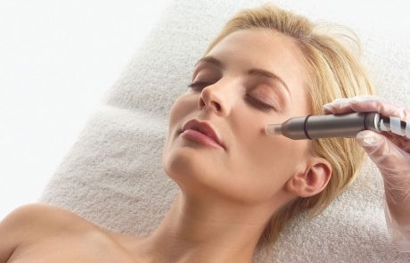Mikrodermabrasion de Dakar Hannover