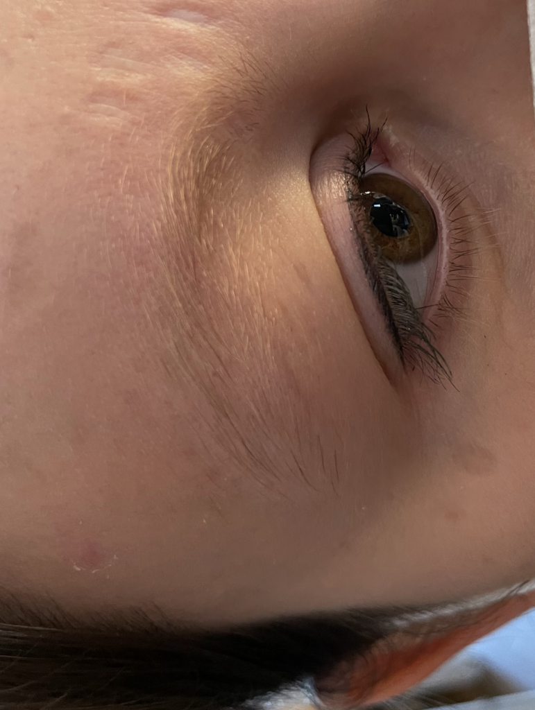 Microblading Hannover vorher nachher